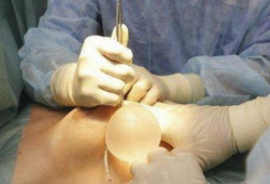 女人刮宫手术实拍视频,真实影像直击